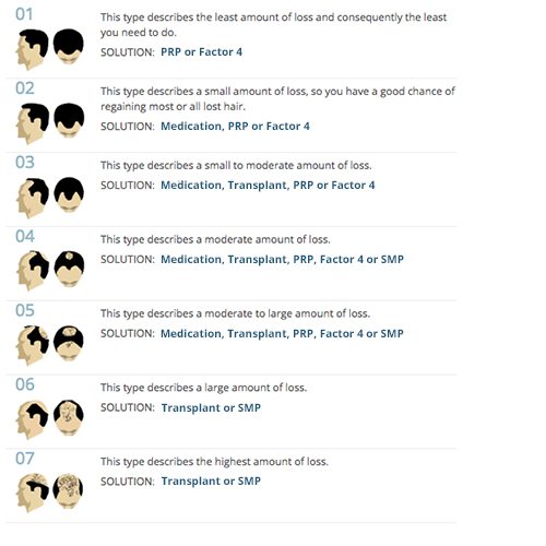 Men’s Hair Loss Treatment Sydney The Crown Clinic