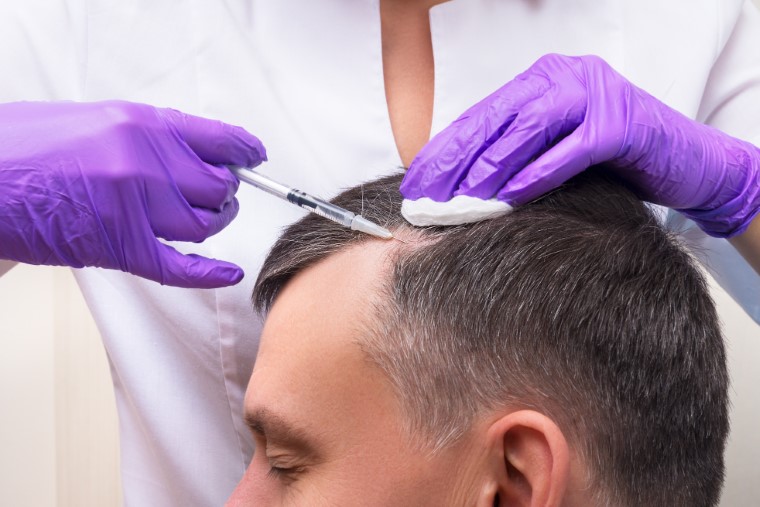 Does Any Hair Loss Treatment Work? Crown Clinic