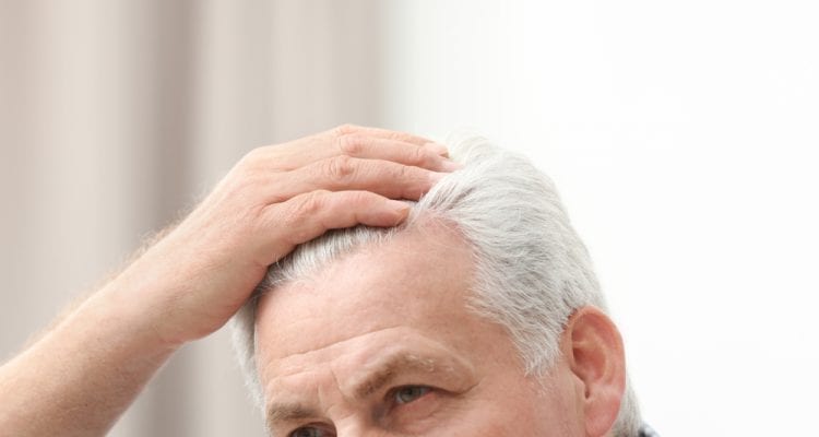 How To Treat Hair Loss Sydney The Crown Clinic