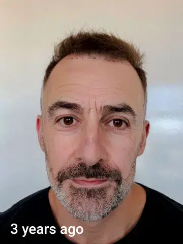 before after results