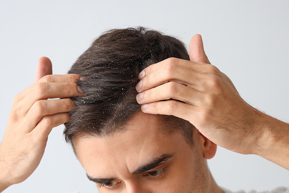 Itchy Scalp and Hair Loss | Itchy Scalp Causes | Itchy Scalp and Hair Falling Out