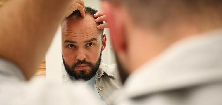 Can Dehydration Cause Hair Loss | Dehydration and Hair Loss